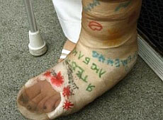 Депутатка Януковича стала Бабкою-Ягою, Кістяною Ногою