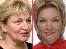 Пластична хірургія та VIP-и: Тимошенко, Кучма, Богатирьова