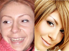 Продюсери двійника Білик відібрали в неї ім’я і показали, як ліпили з неї зірку