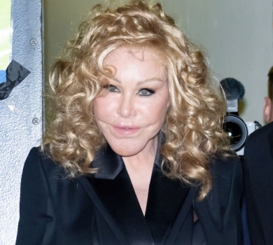 82-річна Жінка-кішка, яка не визнає, що спотворила себе пластикою, показала, якою була. ФОТО