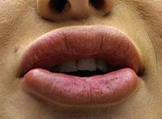 Чоловік Лободи не любить, коли вона випинає губи