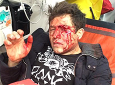 Джеджула заявив про побиття, показав криваві рани та звинуватив Дімопулос