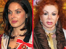 Лохотрон для марнославних, або Бужинська і Чапкіс слідами Сталлоне і Кучми