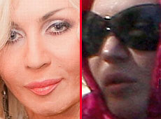 Білик зробила пластику до 40-річчя? ФОТО