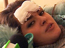 Міс Україна-Всесвіт Стефанко отримала перелом, впавши з неба