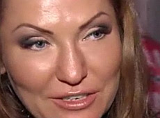 Айсіна радить робити пластику та ін‘єкції ботоксу