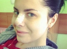 Спасібушечка Лоран показала новий ніс та висловилася про Майдан 