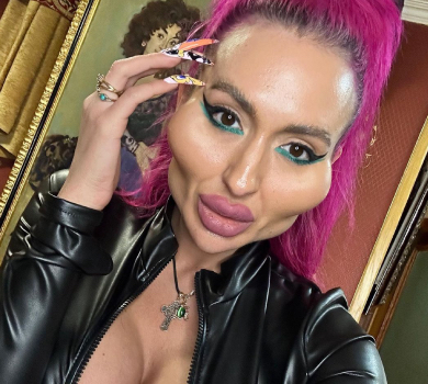 Жінка-вилиці Покрещук показала результат операції, від якої її відмовляли хірурги. ФОТО