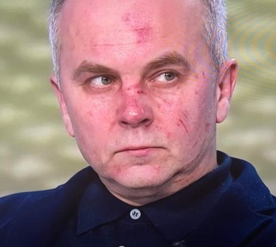 Мураєв наступний: із відлупцьованого Бутусовим Шуфрича кепкують у мережі. ФОТО