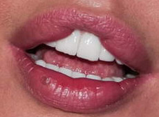 Малиновська показала свої губи Лорак і Подкопаєвій