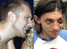 Постраждалий від руки Ларсона показав побої. ФОТО. ВІДЕО