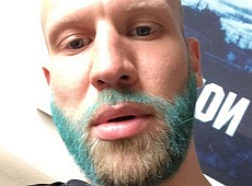 Американський Vogue назвав Дорна порушником гендерних норм в Україні