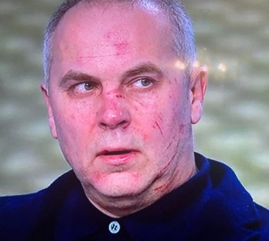 Подряпаний Бутусовим Шуфрич заявив, що побоюється сказу 