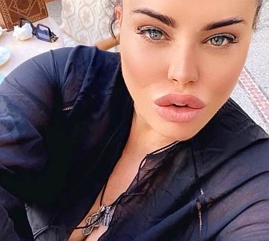 Байрак похизувалася ніжками у яскравому пляжному луці. ФОТО 