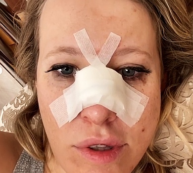 Собчак зі зламаним носом подає в суд на німецьке видання, яке приписало їй дурних чорношкірих