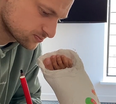 Дубілет замилував мережу відео, на якому розмальовує свою загіпсовану дівчину 