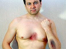 Нагорного побили на замовлення Подкопаєвої? ФОТО