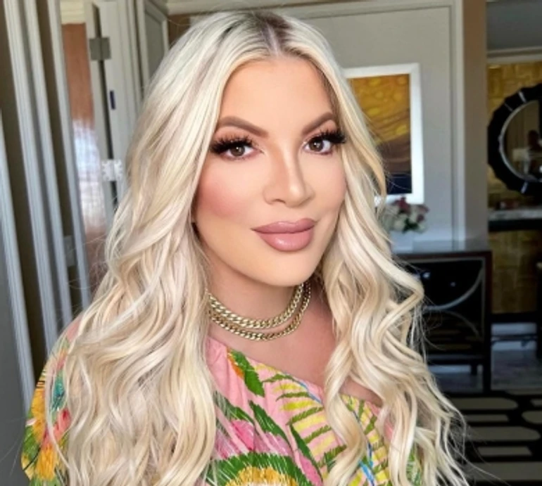 Із синцями на обличчі та в інвалідному візку: 50-річна Спеллінг шокувала виглядом після загадкової госпіталізації