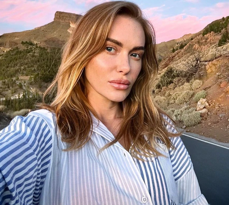 Лопнув імплант: 39-річна Камінська перелічила всі пластичні операції, які нещодавно зробила