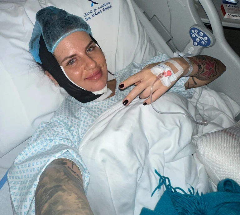 Це було швидке рішення: Алхім в Еміратах зробила пластичну операцію та показала результат. Фото