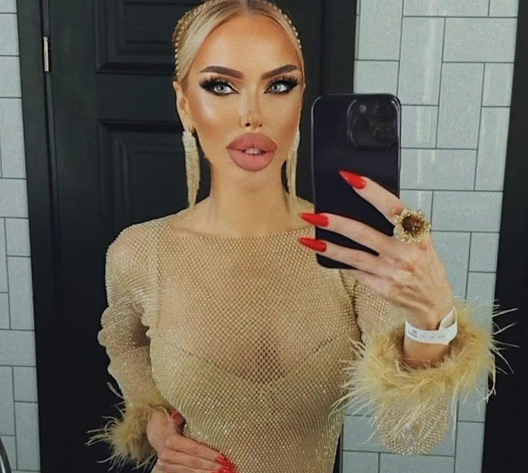 Королева ДНР показала, як виглядала до пластичних операцій. Фото