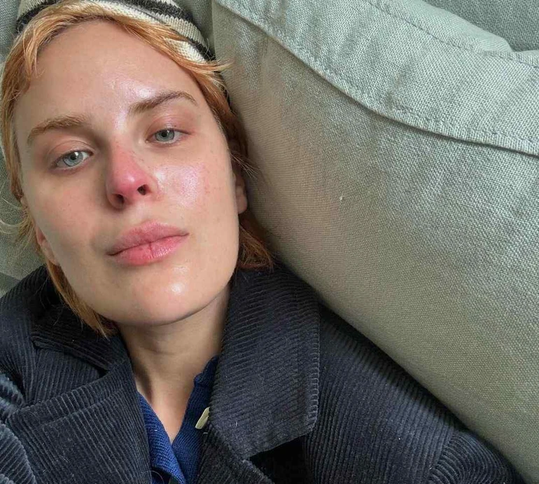 Донька Вілліса і Мур показала, як через психічний розлад нівечила своє обличчя. Фото