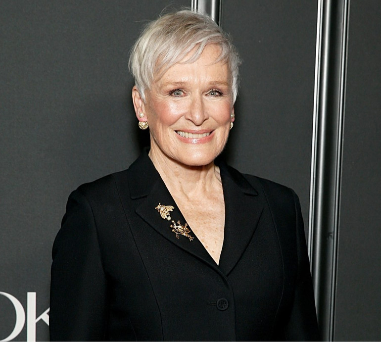 Хороший день: акторка Гленн Клоуз зламала ніс і показалася без мейку та з синцями. Фото