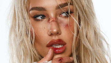 Побита, але не зломлена: Квіткова в саднах і бинтах стала героїнею незвичного фотосету