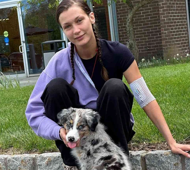 Вовчак, ВІЛ та психічні розлади: з якими захворюваннями живуть і борються зірки