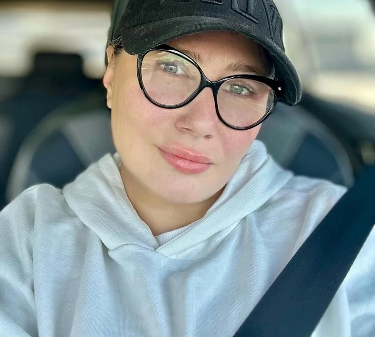 Хочеться дивитись в дзеркало і подобатись собі: Мозгова про зроблену пластичну операцію та ін'єкції краси