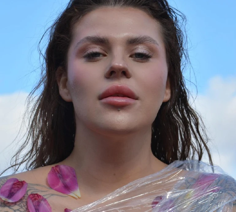 Міміка наробила біди: 31-річна Заріцька показалася на уколах краси