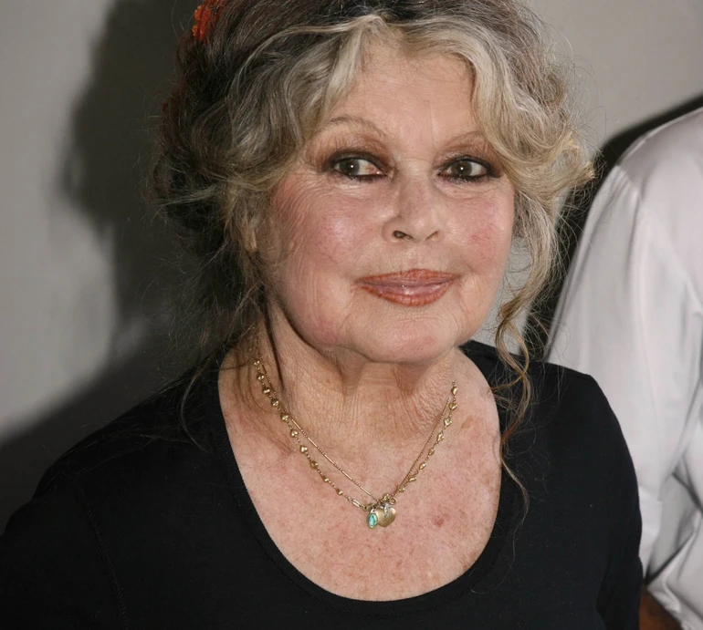 91-річну Бріджит Бардо прооперували: що відомо про стан актриси