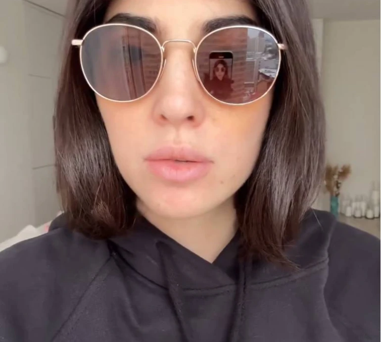 Мусіна показала, як змінювалося обличчя протягом місяця після блефаропластики