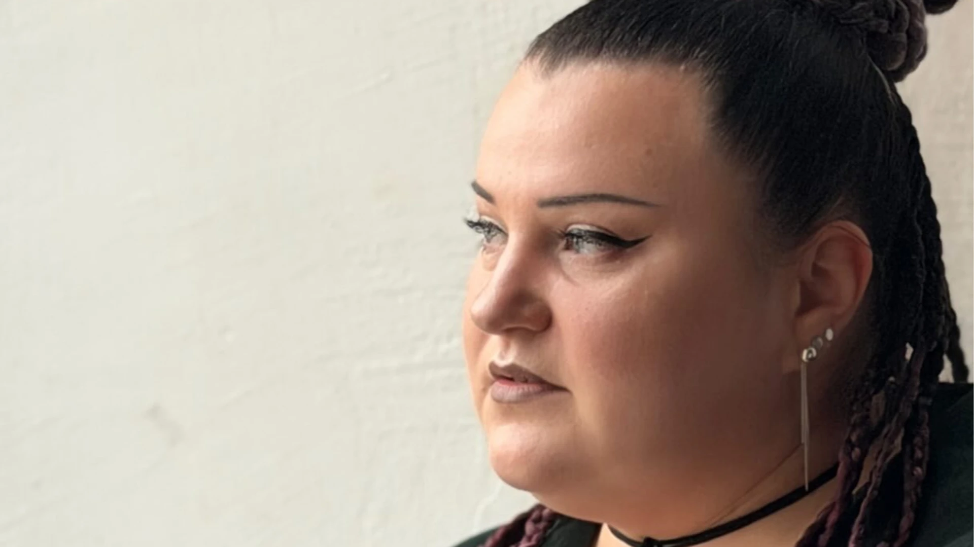 alyona alyona показала живіт після операції зі зменшення шлунку та розповіла про самопочуття