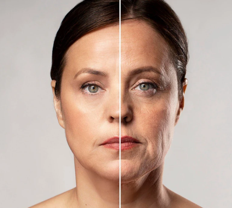 Молодість, яка повертається: чи всі підтяжки обличчя працюють однаково