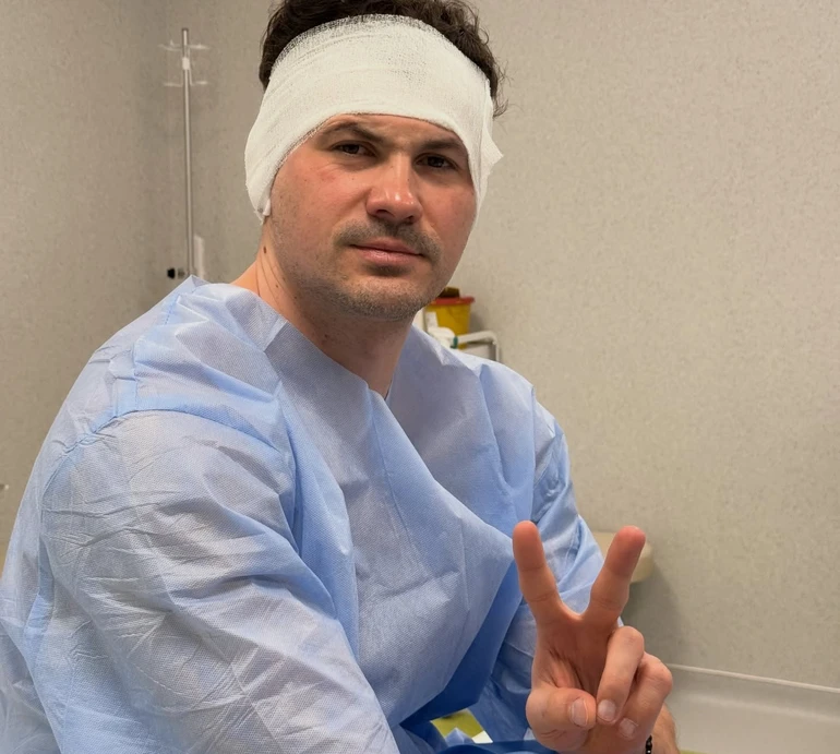 Не тільки естетика: Євген Кот заінтригував операцією на вухах та відповів на критику у мережі