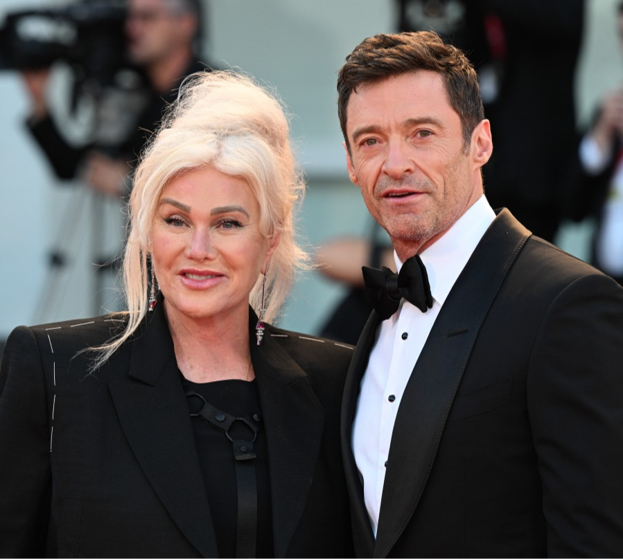 Це глибока рана: ексдружина Джекмана уперше висловилася про зраду, крах майже 30-річного шлюбу і віра у що допомагає їй це пережити