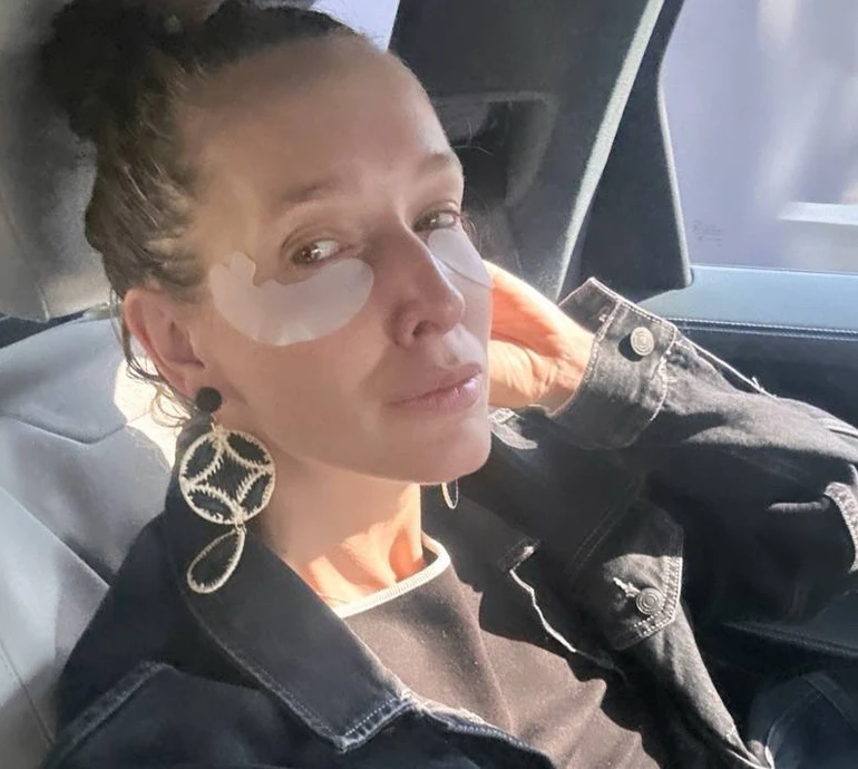 В 14 мені хотіли зробити пластичну операцію: Осадча з мокрою головою і патчами розказала, як долала невпевненість у собі