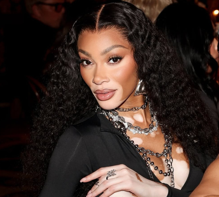 Модель із вітиліго Вінні Харлоу в бікіні спокусливо повигиналася на човні. Фото