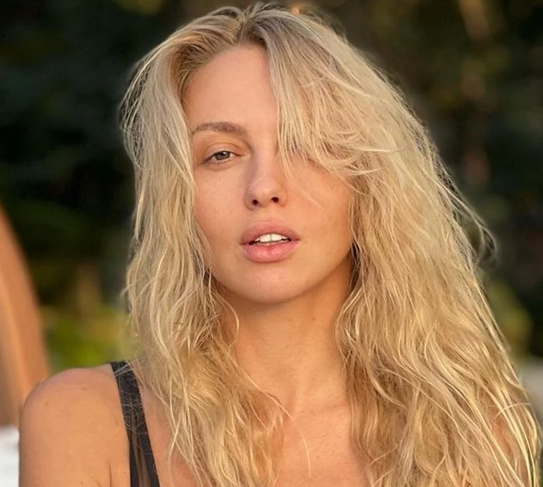 Ось така біда сталася: Полякова шокувала виглядом своєї руки після невдалої ін'єкції