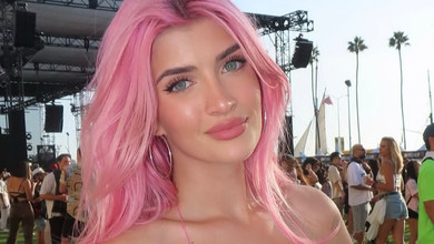 Дякую Богу за філери, пластику грудей, носа та вініри: 21-річна дочка Чарлі Шина показала, як виглядала до всіх операцій. Фото