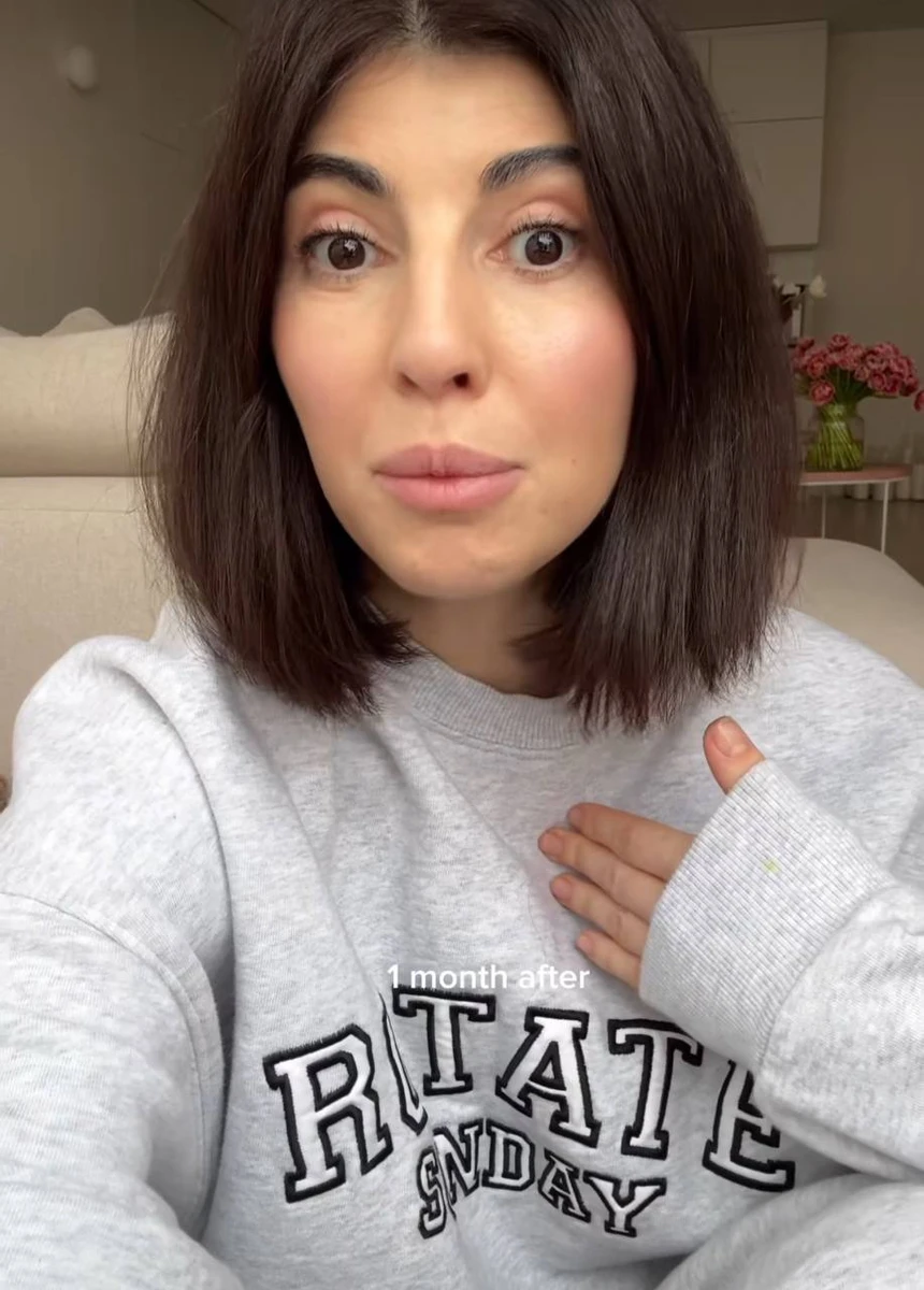 Однак наразі Сабіна задоволена, що змогла повернути своє обличчя