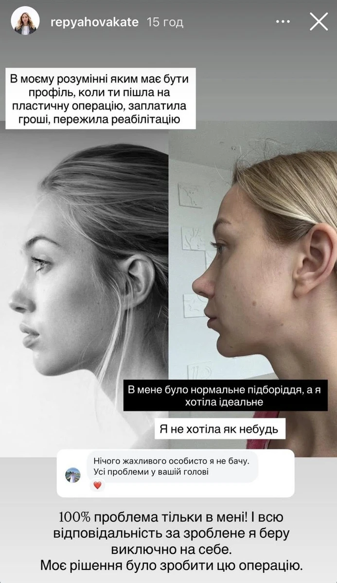 Репяхова не отримала того результату, який мріяла побачити в дзеркалі