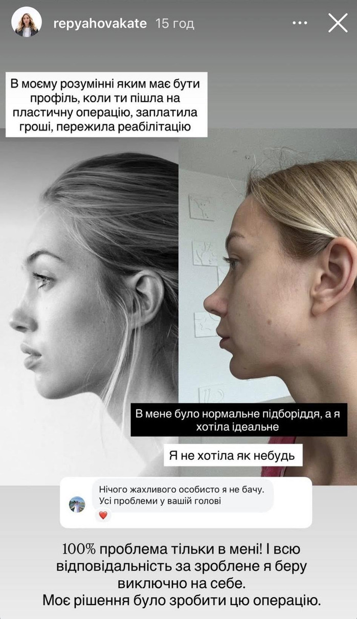 Репяхова не отримала того результату, який мріяла побачити в дзеркалі