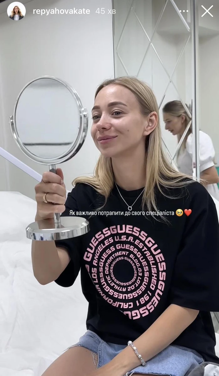 Дружина Віктора Павліка до та після уколів у підборіддя