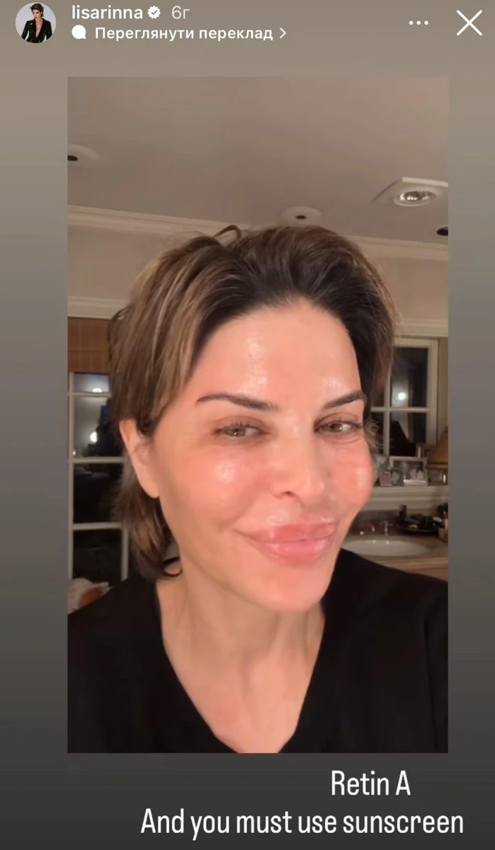 Ліза Рінна радить використовувати ретинол, але спершу краще порадитися з косметологом 
