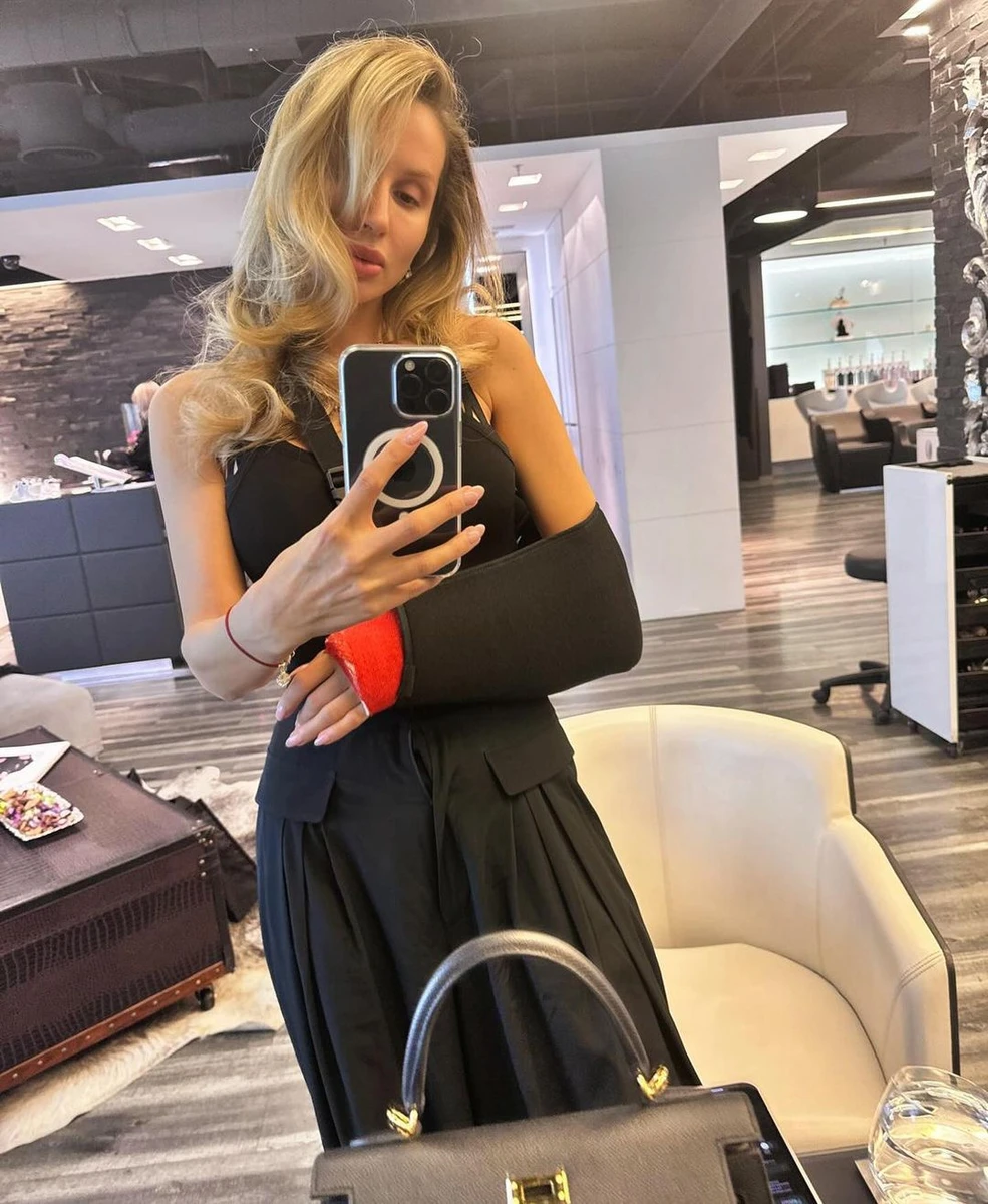 Світлана Лобода з поламаною рукою