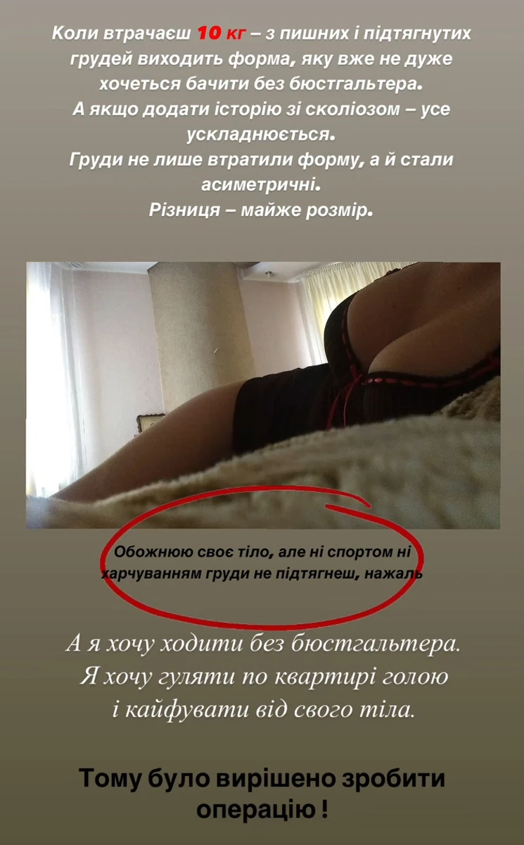 Переможниця Холостяк-13 Бєлєнь розповіла про збільшення грудей