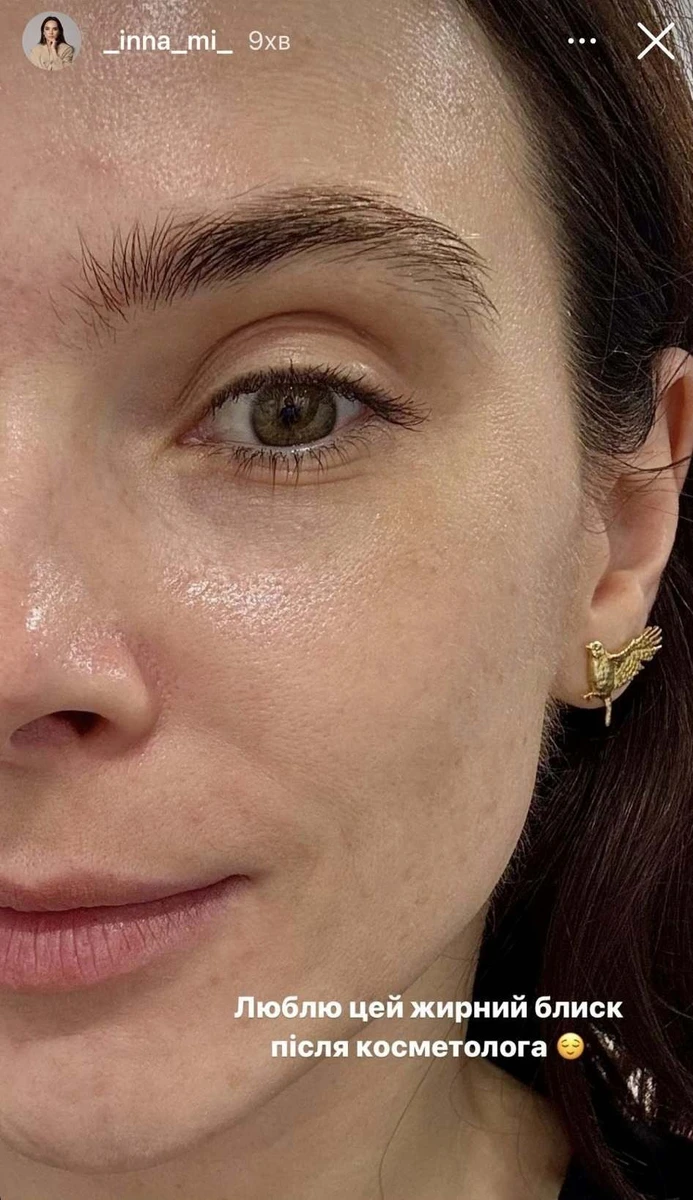 І після неї