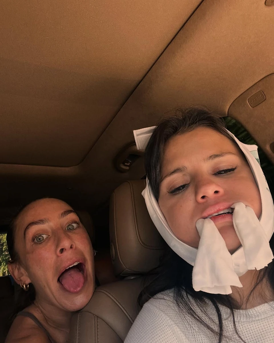 Селена Гомес насмішила фото після лікування зубів